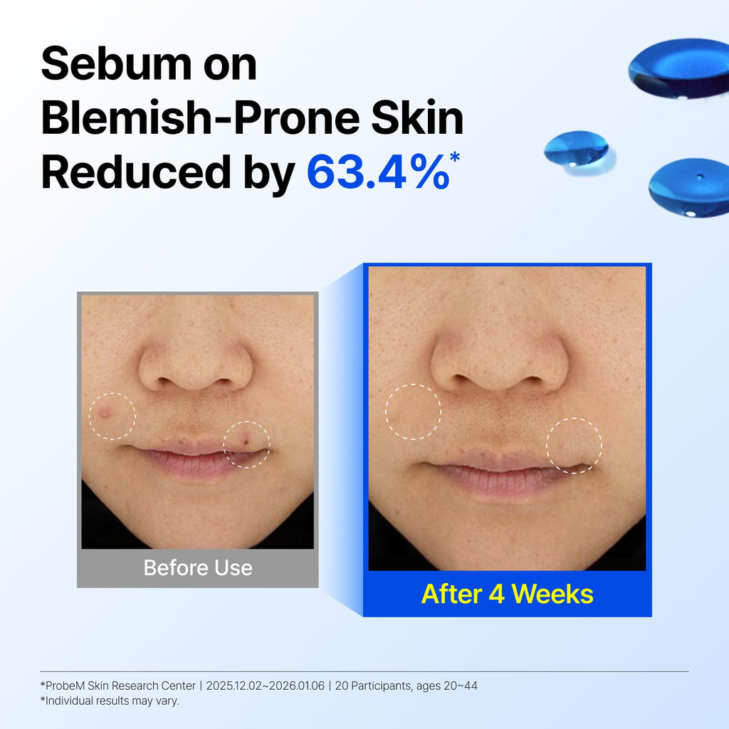 Dear Klairs Korean EGF Serum – Blue Youth Activating Drop with EGF Peptides and Guaiazulene, Repairing Serum for Redness and Blemish-prone Skin, Visibly Fades Post-Blemish Marks, 1.69 Fl Oz